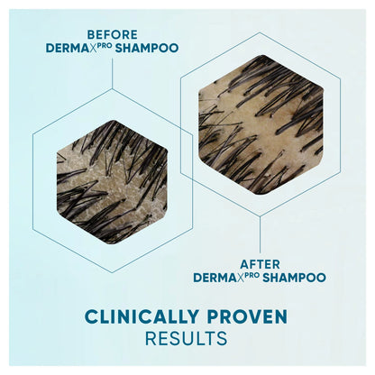 Head And Shoulders Derma X Pro Scalp by HEAD & SHOULDERS