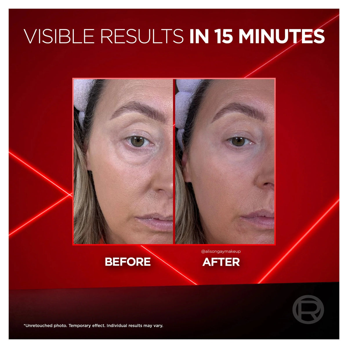 L’oreal Paris Revitalift Laser Eye Bag by L'ORÉAL