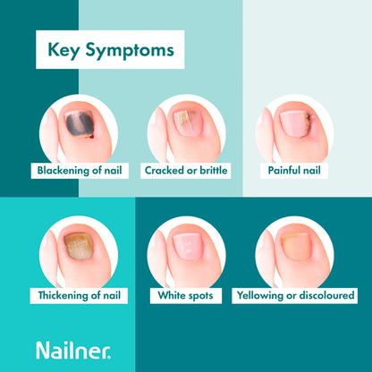 2 In 1 Brush Antifungal Nail by NAILNER