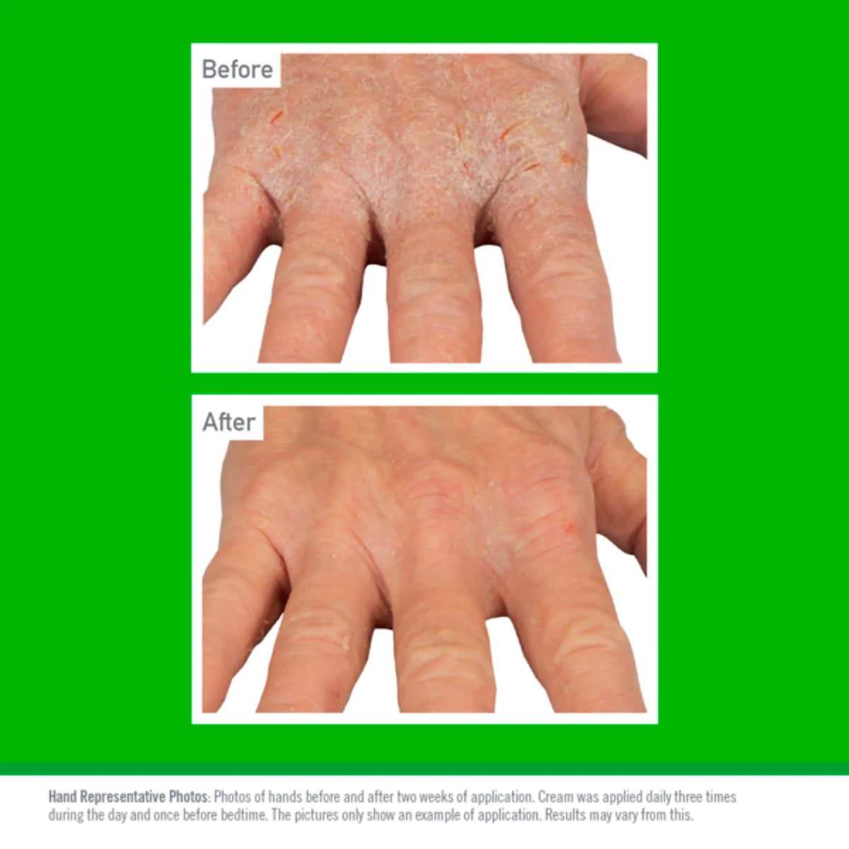 Working Hands Eczema Relief 57g by O'KEEFFE'S