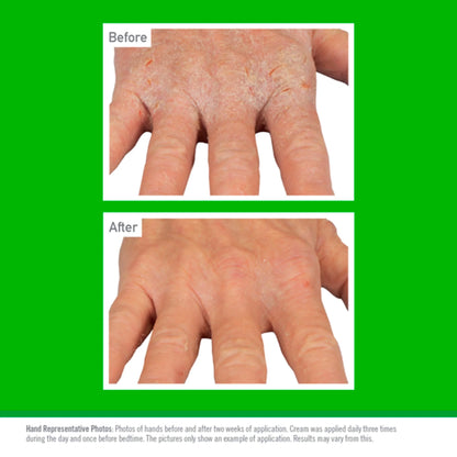 Working Hands Eczema Relief 57g by O'KEEFFE'S