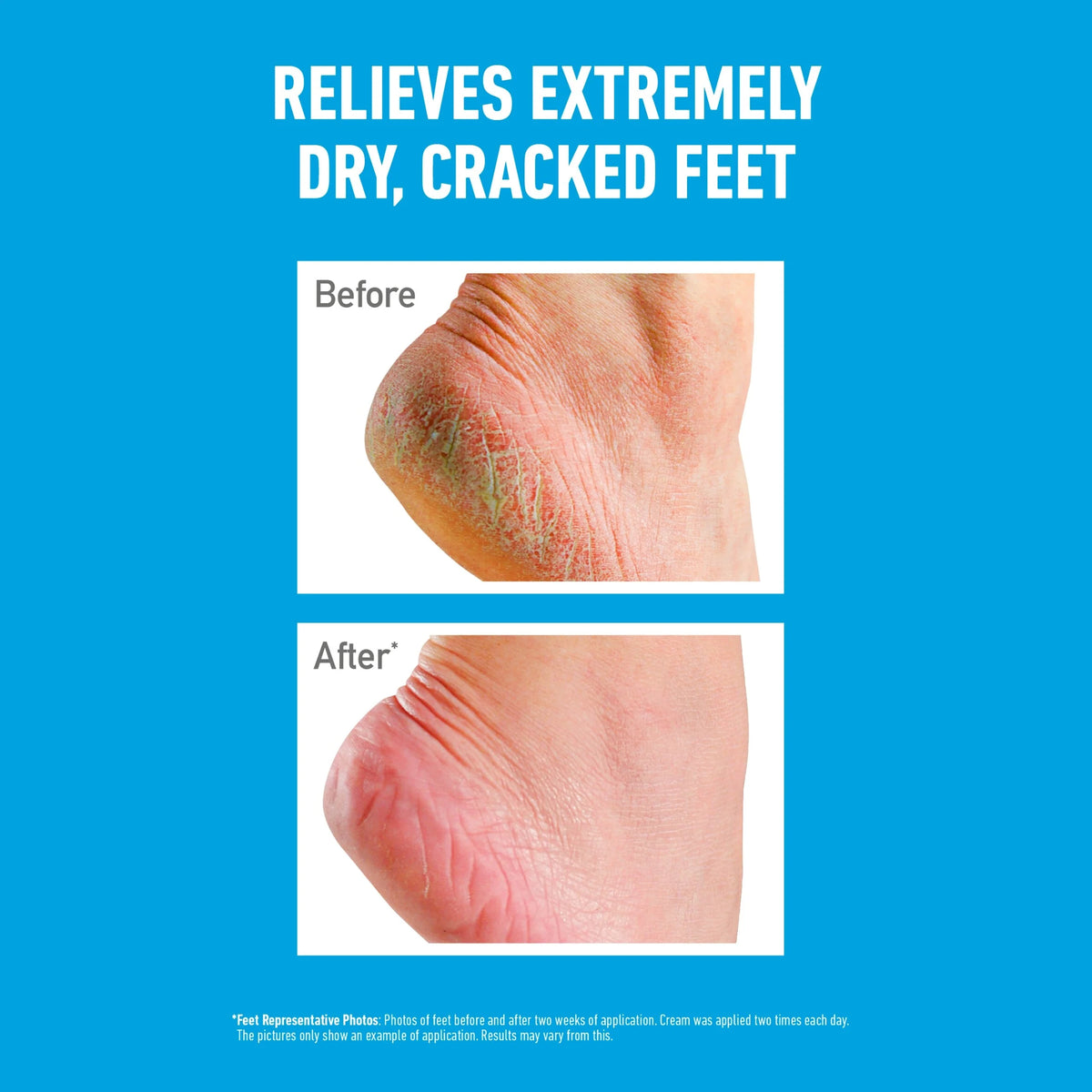 O'keeffees Healthy Foot Cream Jar 91g by DUMMY